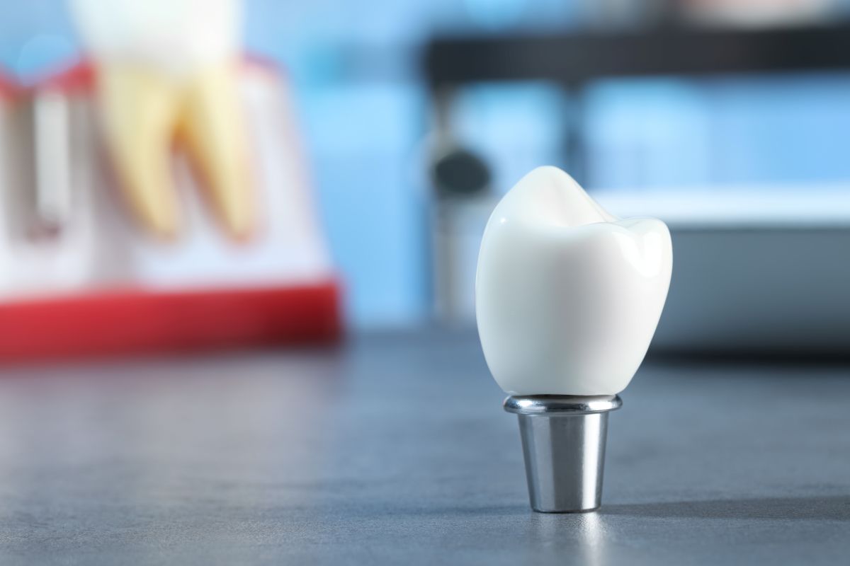 Close-up of a white dental crown on a metal implant abutment on a clinic countertop, with blurred dental models in the background.