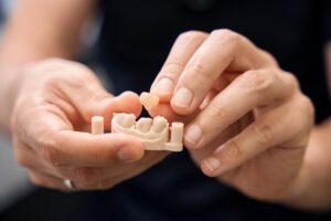 Close-up of hands placing a small dental crown onto a tooth model.