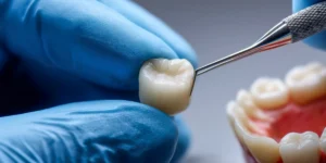 dental crown in encino pricing - Encino Gentle Dental