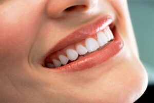 woman after getting veneers - Encino Gentle Dental